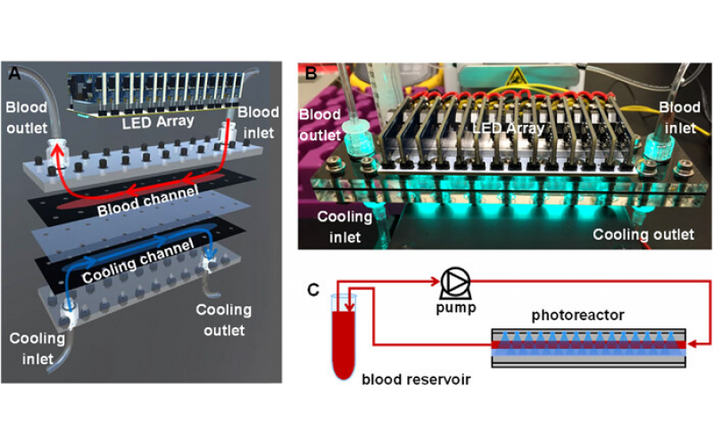 微流控光反應(yīng)器治療新生兒黃疸